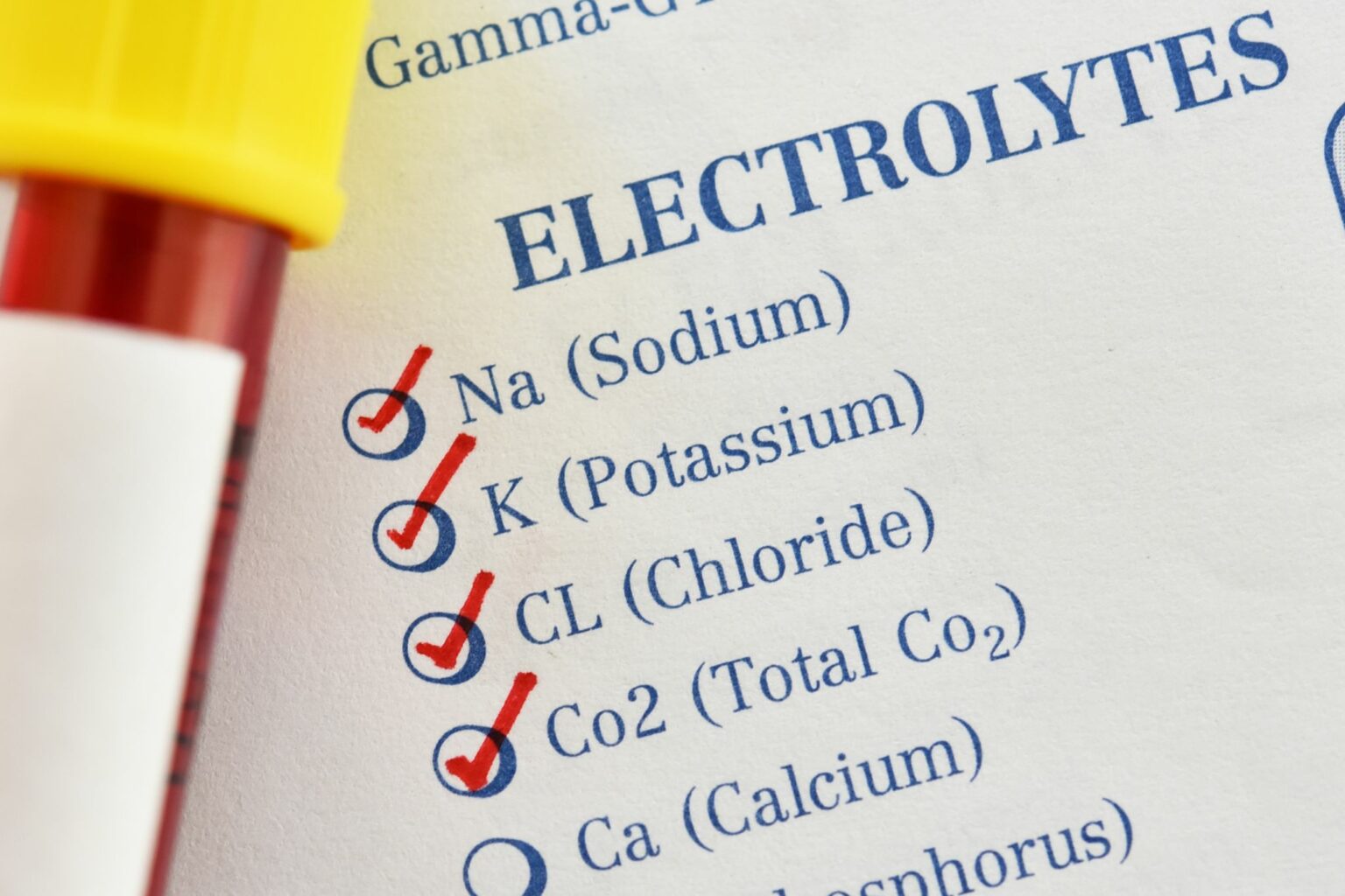 11 Best Electrolytes for Horses That Need to Hydrate