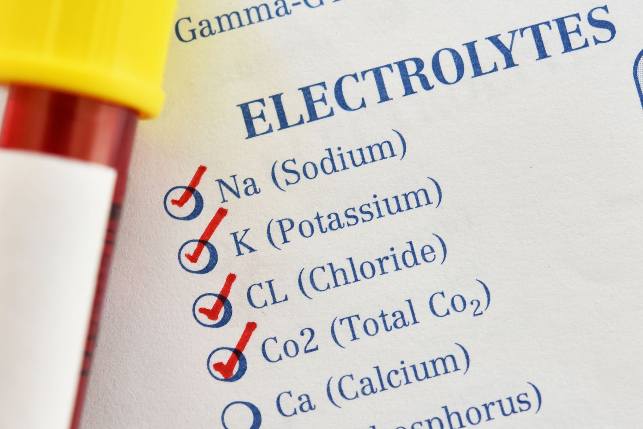 11 Best Electrolytes for Horses That Need to Hydrate